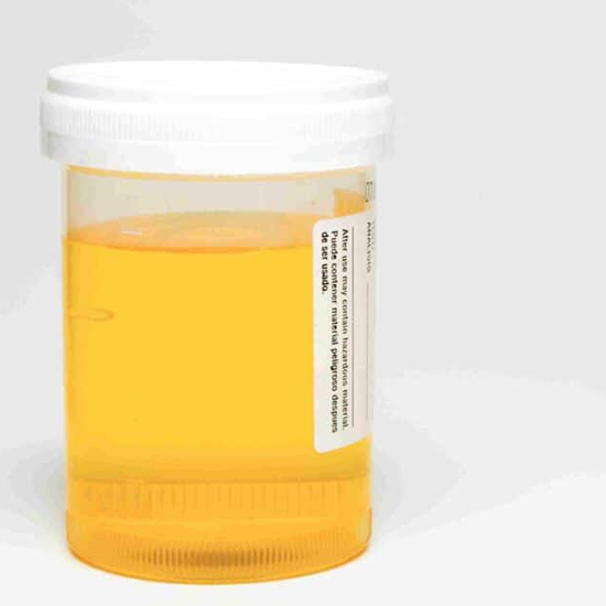 urine bile salts and bile pigments